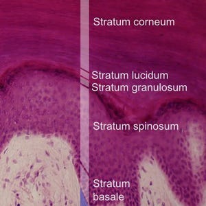 May include: Microscopic image of human skin layers, including the stratum corneum, lucidum, granulosum, spinosum, basale, and dermis. The image is stained in shades of pink and purple, with labels indicating each layer.