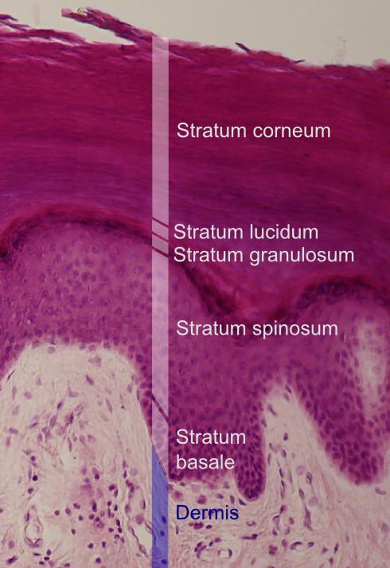 May include: Microscopic image of human skin layers, including the stratum corneum, lucidum, granulosum, spinosum, basale, and dermis. The image is stained in shades of pink and purple, with labels indicating each layer.