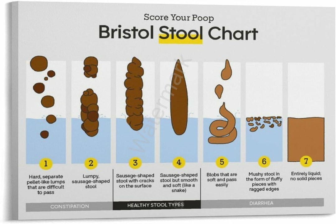 Bristol Stool Chart Poster Digestive Health Infographic Bathroom Wall ...