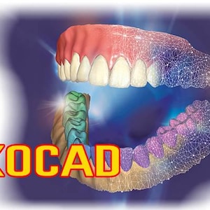 Peut inclure: Un modèle dentaire numérique montrant les dents supérieures et inférieures avec une superposition de maillage filaire passant du blanc réaliste à des dégradés de bleu et de violet. Le mot EXOCAD est affiché en lettres jaunes avec un contour rouge.