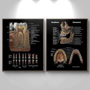 May include: Two framed anatomical dental charts on a black background. One chart shows a cross-section of a tooth with labels. The other chart displays deciduous and permanent teeth with detailed diagrams and labels. The charts are educational and informative.