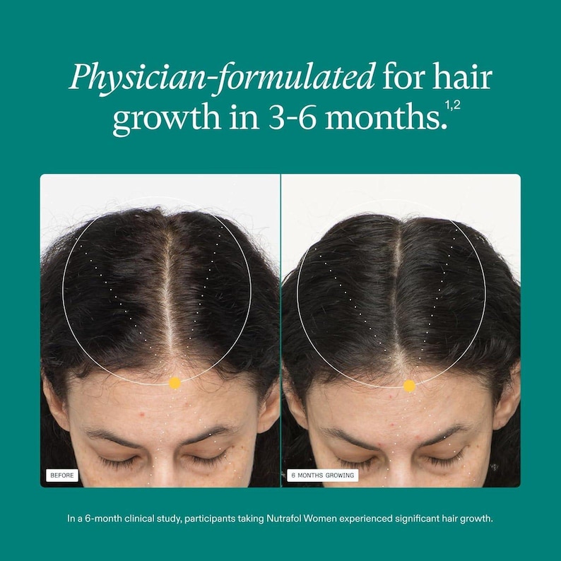 May include: Side-by-side images of a person's scalp, illustrating hair growth. The left image is labeled "BEFORE," and the right image is labeled "6 MONTHS GROWING." Text at the top reads "Physician-formulated for hair growth in 3-6 months."