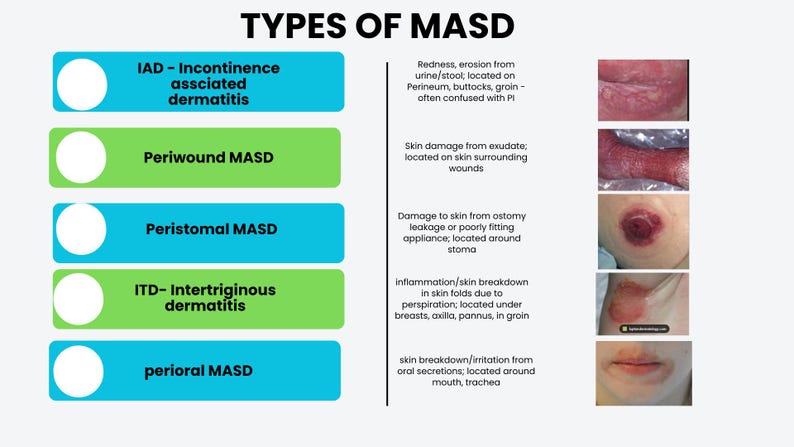 Moisture Associated Skin Damage (MASD) Editable Slide Deck | Wound Care ...