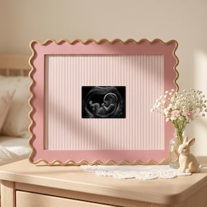 Puede incluir: Un marco de fotos rosa con bordes festoneados que contiene una ecograf&iacute;a en blanco y negro de un feto. El marco presenta un paspart&uacute; con rayas verticales de color rosa claro y blanco. Se exhibe junto a un peque&ntilde;o florero de cristal.