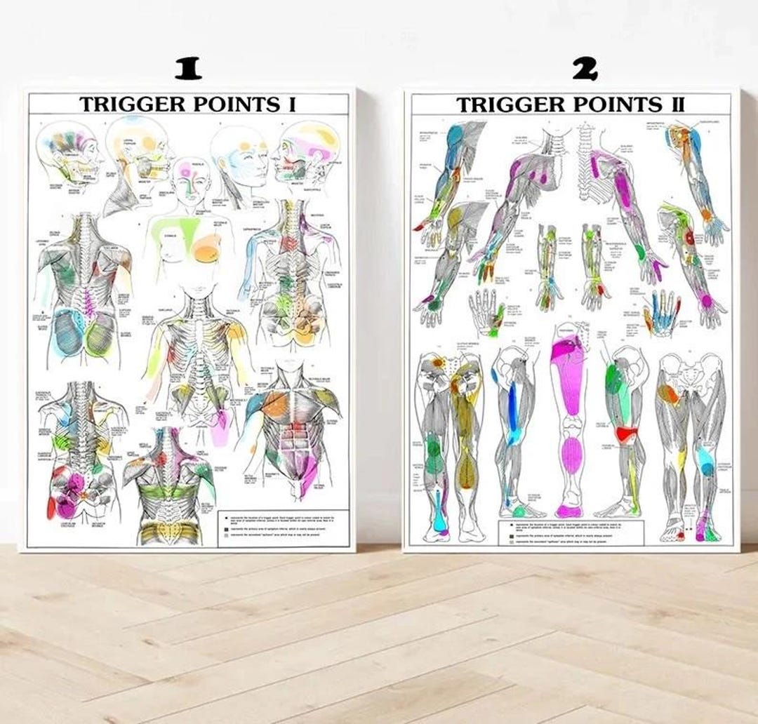 Trigger Point Info Printable Trigger Points 1 2 Anatomical Diagram Guide Chart Anatomy 1 Print ...