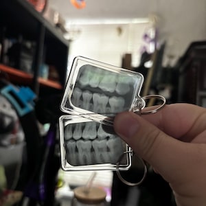May include: Two clear rectangular keychains displaying dental X-ray images. Each keychain has a silver-colored metal frame and a silver key ring. The X-ray images show the teeth in shades of gray and white.