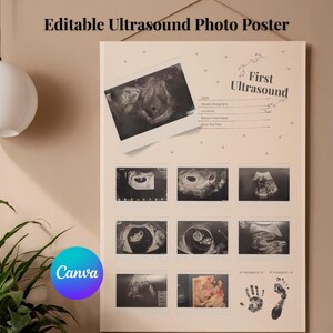 May include: A light-coloured ultrasound photo poster with the text "Editable Ultrasound Photo Poster" at the top. The poster features multiple ultrasound images, the words "First Ultrasound", and space to write details.