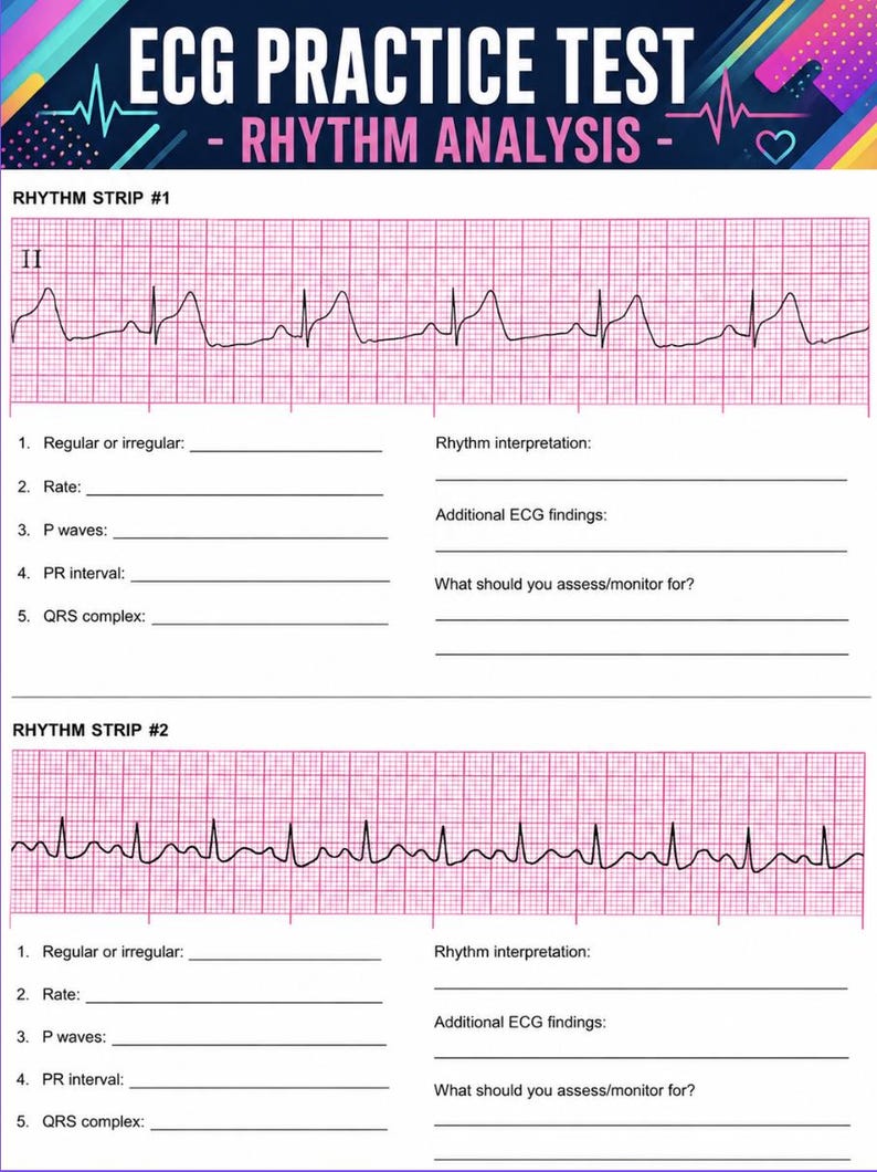 Ecg Test Sample ECG Practice Test Rhythm Strips | Nursing Student Study Guide (digital ...