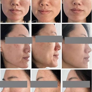 May include: A series of nine images showing a person's face from different angles. The images are arranged in a 3x3 grid, with the text "Day1", "Day2", and "Day5" at the bottom of the images. The person's eyes are covered by a gray bar.