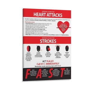 Poster med hjärtinfarkt- och strokesymtom – Hälsoinformationstabell för väggkonst på arbetsplatsen, skolan eller kliniken