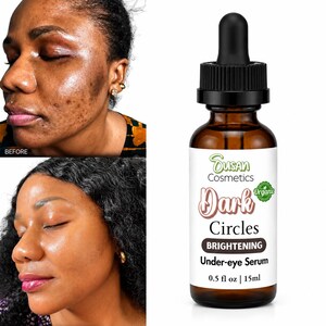Sérum para ojeras, sérum iluminador para el contorno de ojos 15 ml