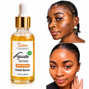May include: A clear glass bottle of Susan Cosmetics Turmeric Serum with a gold dropper cap. The white label features black text reading Turmeric Serum, Brightening, and 1 fl oz | 30 ml. Beside the bottle are two portraits showing skin before and after.