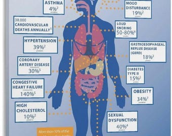 Obstructive Sleep Apnea Poster, Sleep Disorder Medical Infographic, CPAP Clinic Educational Wall Art Print Decor