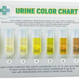 May include: A rectangular medical chart titled URINE COLOR CHART featuring a green cross icon and eight glass test tubes filled with liquids ranging from pale yellow to dark brown. Each tube is numbered one through eight with text instructions.