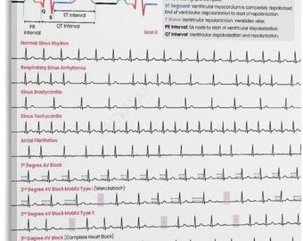 Veterinary ECG Chart Poster Electrocardiography For Dogs And Cats Vet Clinic Wall Art Animal Cardiology Print Decor