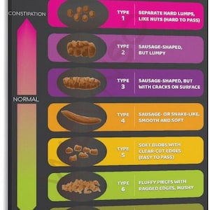 May include: A Bristol Stool Chart poster with a black background. The chart displays seven types of stool, ranging from constipation to diarrhea, with descriptions and illustrations of each type. The text "Bristol Stool Chart" is at the top.