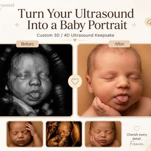 Puede incluir: Imagen promocional de un recuerdo de ultrasonido 3D/4D personalizado. La imagen muestra una comparación de una ecografía y un retrato de bebé. El texto dice "Convierte tu ecografía en un retrato de bebé". También se incluyen imágenes adicionales del bebé.
