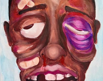 May include: An oil painting on canvas depicting a person with a bruised face, featuring a large purple and blue swelling around one eye, a bloody nose, and missing teeth. Two beige adhesive bandages are applied to the forehead and cheek.