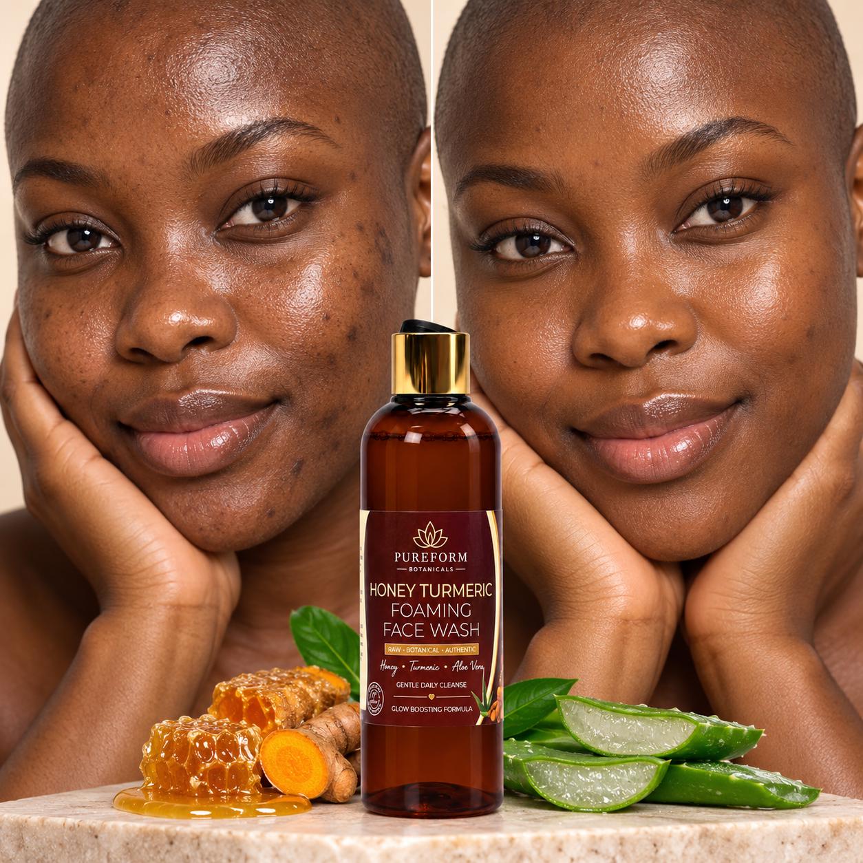 Honey Turmeric Foaming Face Wash Botanical Aloe Vera Cleanser (150ml)