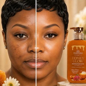 Uneven Skin Tone  Hyperpigmentation Honey Glow Brightening Body Lotion: Deep Hydration, Healthy Glow