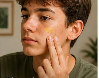 Botanical Acne Calm Balm | 4 oz Face Balm for Sensitive Skin, Redness