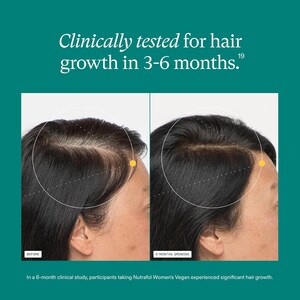 May include: Image showing before and after photos of hair growth. The text reads "Clinically tested for hair growth in 3-6 months." The "before" photo shows thinning hair, while the "6 months growing" photo shows thicker hair. The text at the bottom states the study details.