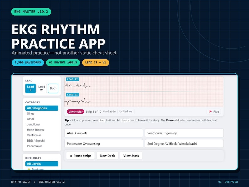Op de afbeelding: De EKG Master v10.2 app-interface toont een EKG-ritme oefentool met 1.500 golfvormen en 62 ritmelabels. Het scherm bevat Lead II en Lead V1 grafieken, categorie-selectie, moeilijkheidsgraden en knoppen voor pauze, nieuwe deck en statistieken bekijken.
