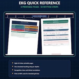 May include: An EKG Quick Reference guide featuring 8 printable pages and 50 rhythm strips. The document includes clinical reference series cards with color-coded rhythm classifications, recognition clues, and clinical correlations for educational use.