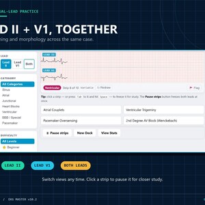 Op de afbeelding: Een digitale interface voor EKG-ritmeoefeningen getiteld LEAD II + V1, TOGETHER. Het toont twee elektrocardiogramstrips op een raster, met selectiemenu's voor afleidingen, categorie&euml;n en moeilijkheidsgraden, plus knoppen voor pauze en statistieken.