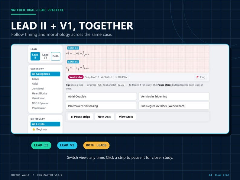 Op de afbeelding: Een digitale interface voor EKG-ritmeoefeningen getiteld LEAD II + V1, TOGETHER. Het toont twee elektrocardiogramstrips op een raster, met selectiemenu's voor afleidingen, categorie&euml;n en moeilijkheidsgraden, plus knoppen voor pauze en statistieken.