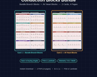 Bundle Branch Block ECG Reference Card | Dual-Lead Tracings, Nursing Study Guide (Digital Download)