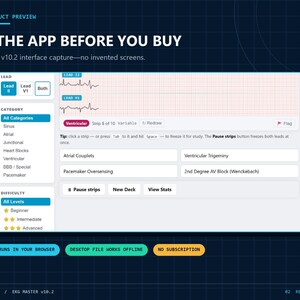 Op de afbeelding: Een digitale interface voor EKG Master v10.2 met een applicatie voor medische ritmeanalyse. Het scherm toont Lead II en Lead V1 golfvormen op een raster, met menu's voor categorie- en moeilijkheidsgraadselectie en knoppen voor diverse functies.