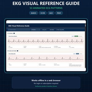 May include: A digital EKG visual reference guide featuring 53 animated ECG patterns. The interface displays a normal sinus rhythm and sinus bradycardia with detailed clinical data, search, filter, quiz, and print functions for educational use.