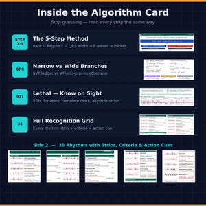 May include: A dark blue educational reference card titled Inside the Algorithm Card. It features a 5-step method for ECG analysis, QRS branch comparisons, lethal rhythm identification, and a 36-rhythm recognition grid with strips, criteria, and action cues.