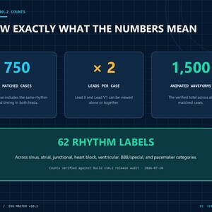 Op de afbeelding: Een donkerblauwe infographic getiteld KNOW EXACTLY WHAT THE NUMBERS MEAN, met gegevens voor AUDITED V10.2 COUNTS. Het toont 750 MATCHED CASES, 2 LEADS PER CASE, 1.500 ANIMATED WAVEFORMS en 62 RHYTHM LABELS in diverse hartritmecategorie&euml;n.