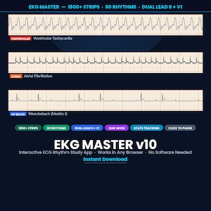 EKG Master v10 | 1818 Animated ECG Strips | 60 Rhythms | Interactive Quiz | Phone + Computer | Digital Download