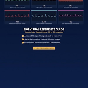 Op de afbeelding: Een donkerblauwe EKG visuele referentiegids met geannoteerde ECG-strips, diagnostische criteria en side-by-side vergelijkingen. De gids bevat labels voor verschillende ritmes, blokken en speciale patronen. De tekst "Directe digitale download" is zichtbaar.
