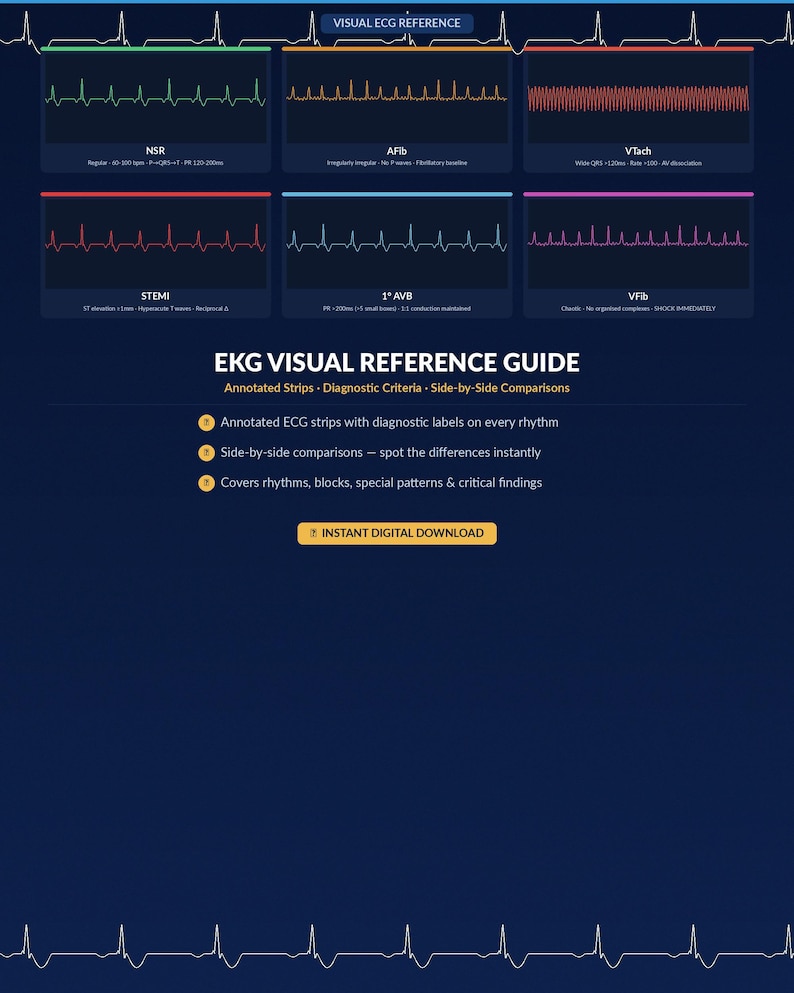 Op de afbeelding: Een donkerblauwe EKG visuele referentiegids met geannoteerde ECG-strips, diagnostische criteria en side-by-side vergelijkingen. De gids bevat labels voor verschillende ritmes, blokken en speciale patronen. De tekst "Directe digitale download" is zichtbaar.