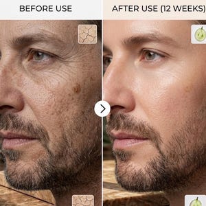 LifeCell Anti Aging Skin Tightening Cream | Wrinkle & Firming Face Moisturizer with Retinol, Peptides, Vitamin C and Hyaluronic Acid image 4
