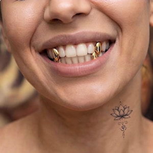 Könnte beinhalten: Ein Set aus drei polierten Goldkappen für die Zähne, die auf den oberen und unteren Zähnen angebracht sind. Die Goldkappen haben ein glattes, metallisches Aussehen. Zusätzlich ist ein schwarzes Tattoo einer Lotusblume mit einem Om-Symbol am Hals zu sehen.
