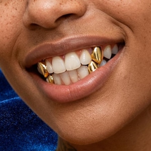 Puede incluir: Un conjunto de fundas dentales de oro, también conocidas como grills, ajustadas sobre dientes individuales. Los recubrimientos de oro metálico están colocados en los dientes superiores e inferiores, creando una superficie lisa y brillante.