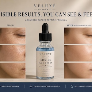 Puede incluir: Un frasco cuentagotas de vidrio transparente de suero azul Veluxe Glowkit GHK-Cu con tapa cuentagotas negra. La etiqueta dice GHK-Cu Blue Serum, Advanced Copper Peptide Formula, 1 fl oz, 30 ml. La imagen incluye paneles de comparaci&oacute;n de piel.