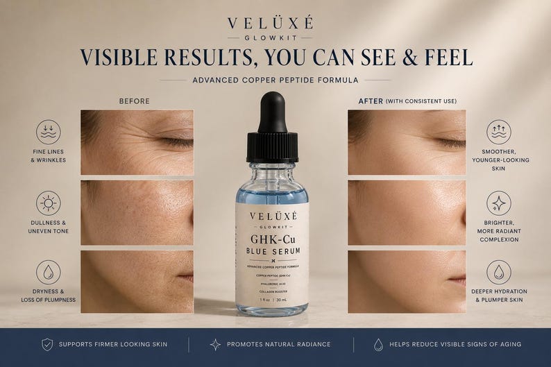 Puede incluir: Un frasco cuentagotas de vidrio transparente de suero azul Veluxe Glowkit GHK-Cu con tapa cuentagotas negra. La etiqueta dice GHK-Cu Blue Serum, Advanced Copper Peptide Formula, 1 fl oz, 30 ml. La imagen incluye paneles de comparaci&oacute;n de piel.