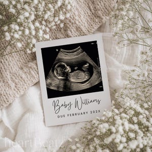 May include: A rectangular white announcement card featuring a black and white ultrasound image of a fetus. The text reads Baby Williams and DUE FEBRUARY 202X in a combination of script and sans-serif fonts, centered below the ultrasound scan.