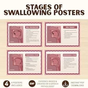 Op de afbeelding: Vier educatieve posters getiteld STAGES OF SWALLOWING POSTERS, met details over de orale voorbereidingsfase, orale transitfase, faryngeale fase en oesofageale fase. Elke poster bevat een dwarsdoorsnedediagram van de menselijke keel en tekst.