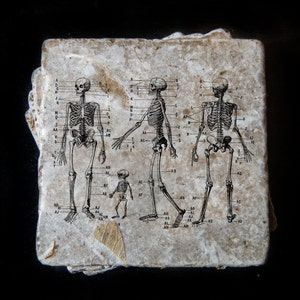 May include: A vintage anatomical chart printed on a beige paper background. The chart shows three skeletons with labels for different bones. The skeletons are labeled with letters and numbers.
