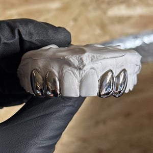 Op de afbeelding: Een tandheelkundige mal met zilverkleurige tandkappen. De kappen zijn hoogglans gepolijst en reflecteren licht. De mal is wit en lijkt van gips te zijn. De afbeelding is genomen tegen een neutrale achtergrond.