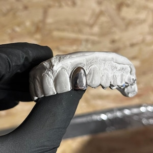 Può includere: Un cappuccio per denti color argento è esposto su un calco dentale bianco. Il calco dentale presenta diverse impronte di denti. Lo sfondo è di colore marrone chiaro.