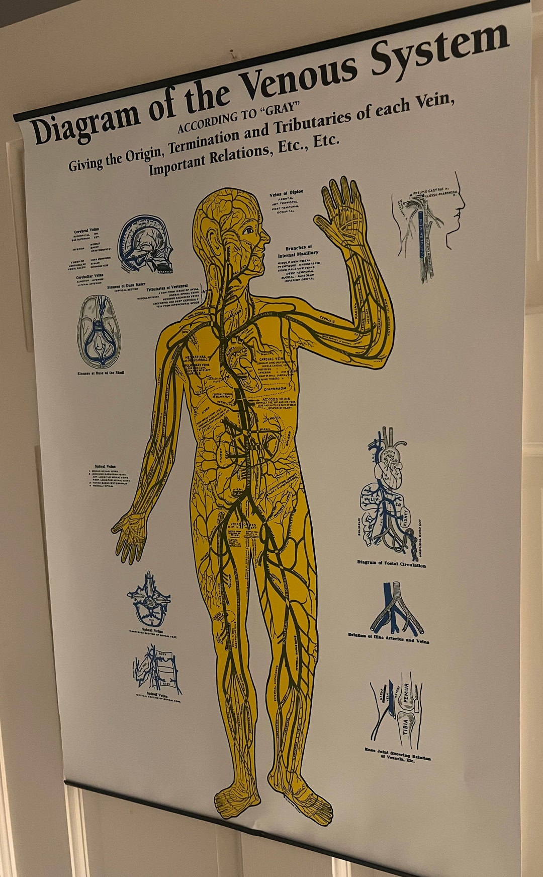 Embalming Guide Anatomical Body Embalming _ What Is Embalming? A Guide To The Embalming ...