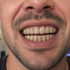 May include: A set of gold grillz covering both the upper and lower teeth, featuring a dense, pavé-style arrangement of small, clear, reflective stones that cover the entire surface of each tooth cap, creating a uniform, sparkling, metallic appearance.